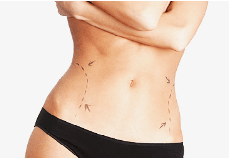 Plastic Surgery in Hebron and Cincinnati