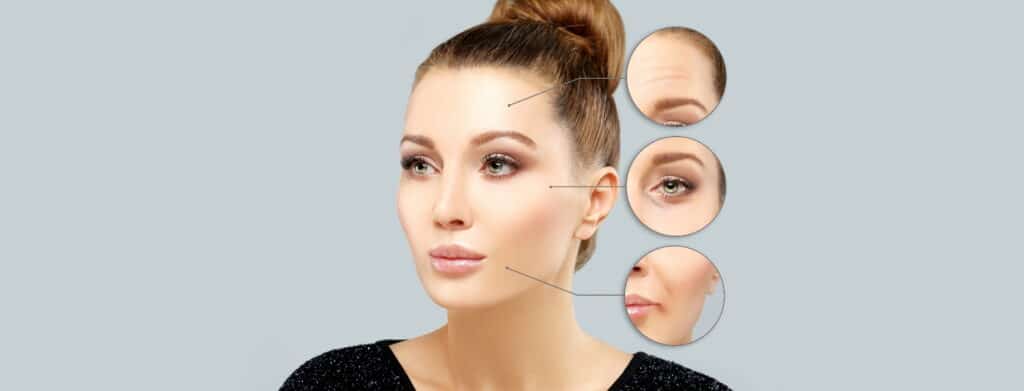 botox and dysport Featured